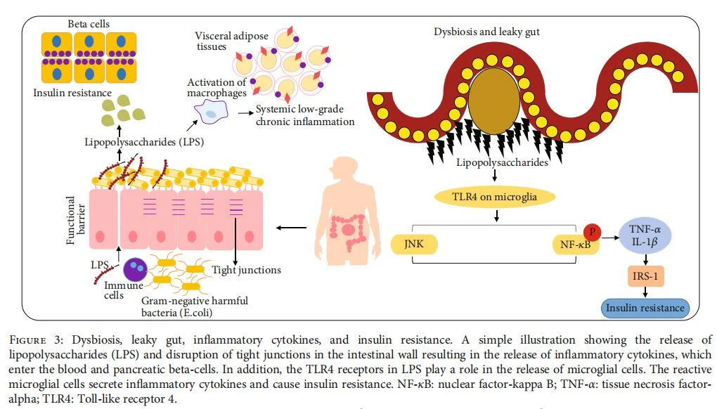 Dysbiosis, leaky gut, inflammatory cytokines, and insulin resistance. A simple illustration showing the release of lipopolysaccharides (LPS) and disruption of tight junctions in the intestinal wall resulting in the release of inflammatory cytokines, which enter the blood and pancreatic beta-cells. In addition, the TLR4 receptors in LPS play a role in the release of microglial cells. The reactive microglial cells secrete inflammatory cytokines and cause insulin resistance. NF-κB: nuclear factor-kappa B; TNF-α: tissue necrosis factoralpha; TLR4: Toll-like receptor 4