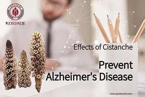 Anti Alzheimers 9 Anti Alzheimers 9